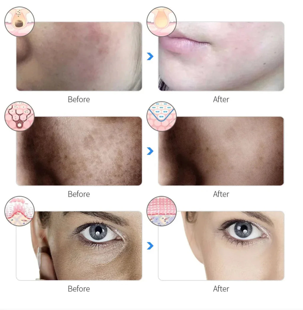 Photon Therapy Beauty Mask