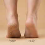 Automatic Foot Grinder