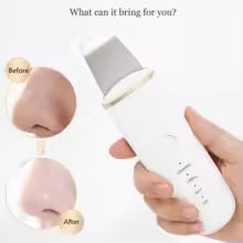 AquaGlow Ultrasonic Skin Scrubber